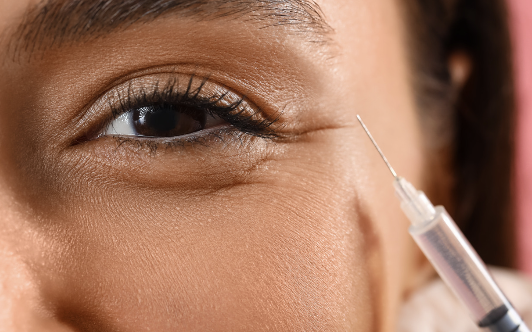Botox Appointment Pricing and Availability Near Potomac, MD